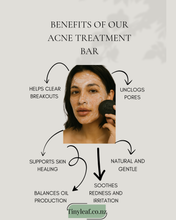 Load image into Gallery viewer, Acne Kawakawa + Charcoal Face Body Bar – Natural Treatment Soap &amp; Free Soap Bag